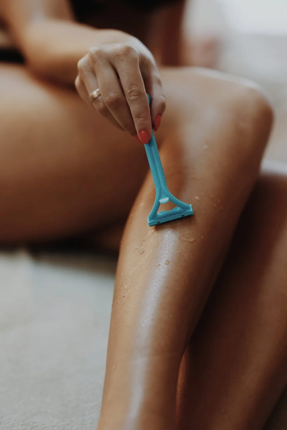 Laserska epilacija fotografija 3 - a.mi medspa