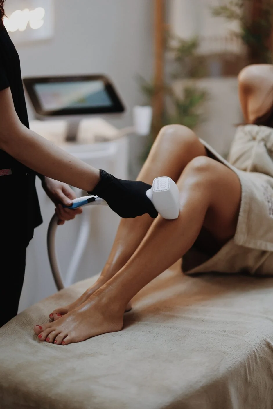 Laserska epilacija fotografija 4 - a.mi medspa